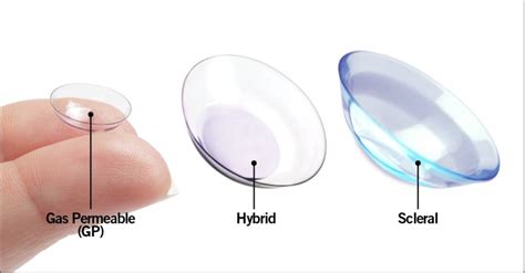 Ordering contact lenses made easy with 1